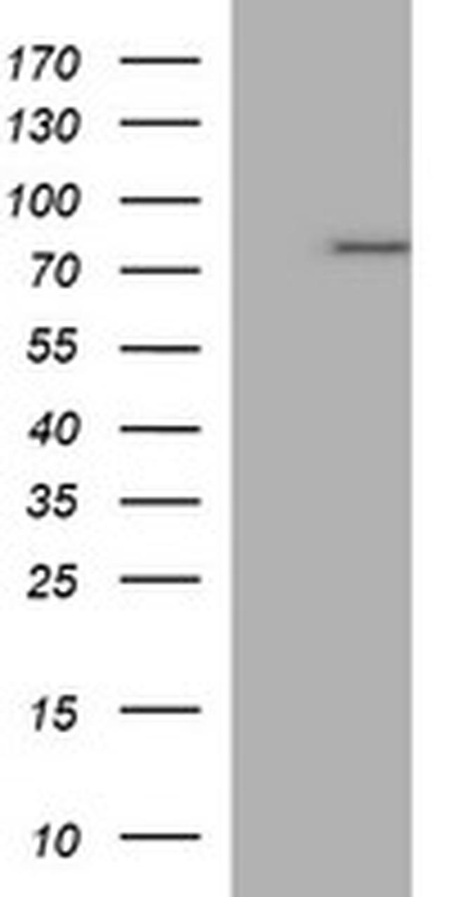 TP73 Antibody in Western Blot (WB)