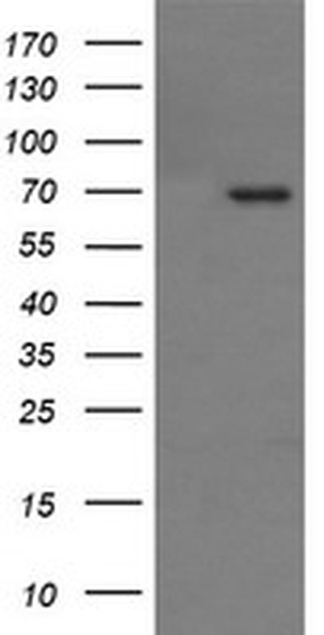 TP73 Antibody in Western Blot (WB)