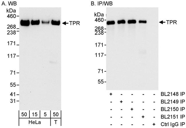 TPR Antibody in Western Blot (WB)