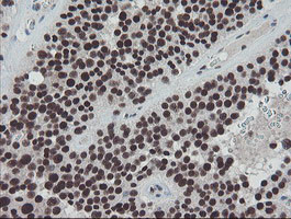 TPRKB Antibody in Immunohistochemistry (Paraffin) (IHC (P))