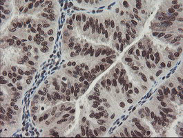 TPRKB Antibody in Immunohistochemistry (Paraffin) (IHC (P))