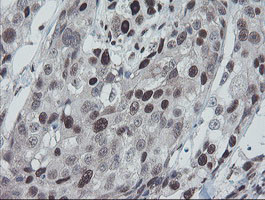 TPRKB Antibody in Immunohistochemistry (Paraffin) (IHC (P))