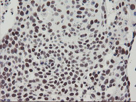 TPRKB Antibody in Immunohistochemistry (Paraffin) (IHC (P))