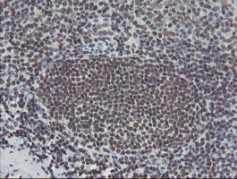 TPRKB Antibody in Immunohistochemistry (Paraffin) (IHC (P))