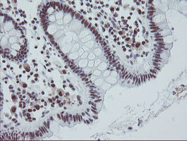 TPRKB Antibody in Immunohistochemistry (Paraffin) (IHC (P))