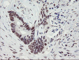 TPRKB Antibody in Immunohistochemistry (Paraffin) (IHC (P))