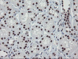 TPRKB Antibody in Immunohistochemistry (Paraffin) (IHC (P))