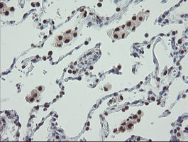 TPRKB Antibody in Immunohistochemistry (Paraffin) (IHC (P))