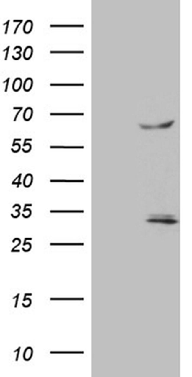 TRAF5 Antibody in Western Blot (WB)