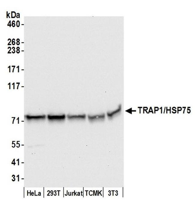 TRAP1/HSP75 Antibody in Western Blot (WB)