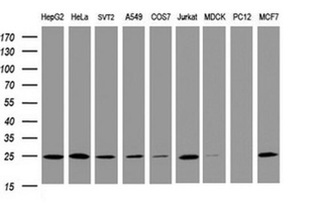 TRAPPC4 Antibody in Western Blot (WB)