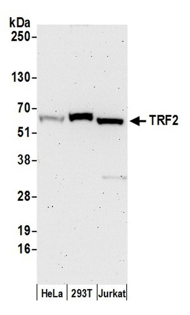 TRF2 Antibody in Western Blot (WB)