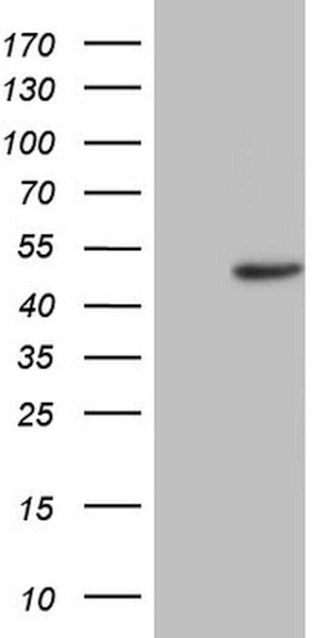 TRIB1 Antibody in Western Blot (WB)