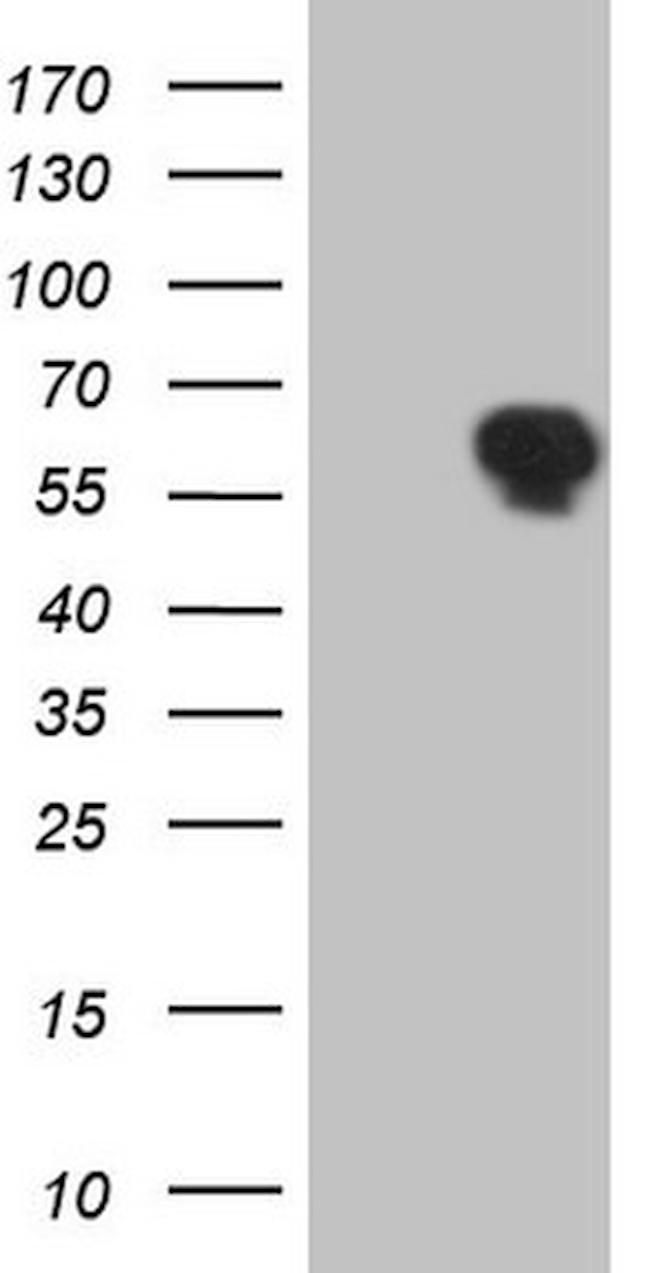 TRIB1 Antibody in Western Blot (WB)