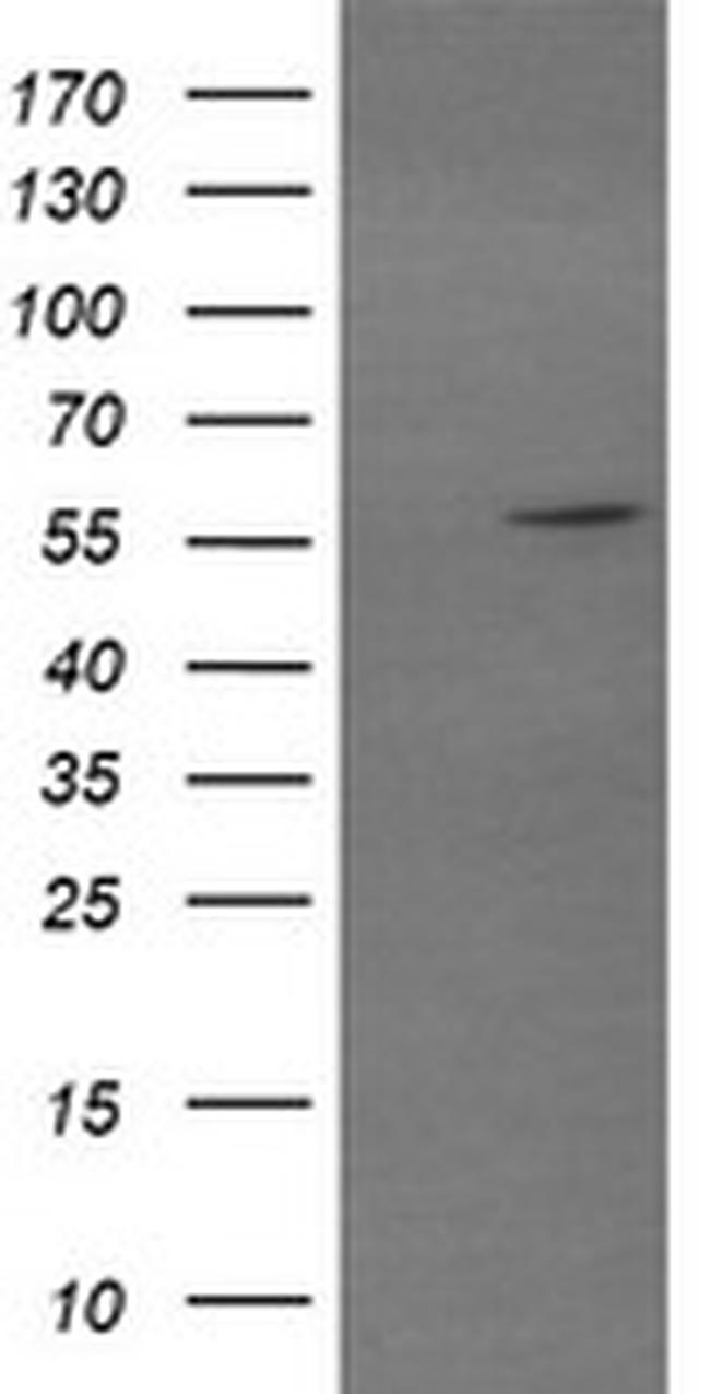 TRIM22 Antibody in Western Blot (WB)