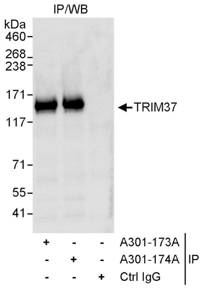 TRIM37 Antibody in Immunoprecipitation (IP)