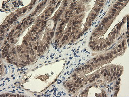 TRIM45 Antibody in Immunohistochemistry (Paraffin) (IHC (P))