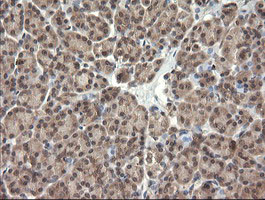 TRIM45 Antibody in Immunohistochemistry (Paraffin) (IHC (P))