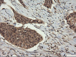 TRIM45 Antibody in Immunohistochemistry (Paraffin) (IHC (P))