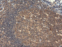 TRIM45 Antibody in Immunohistochemistry (Paraffin) (IHC (P))