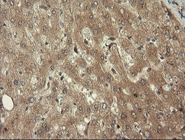 TRIM45 Antibody in Immunohistochemistry (Paraffin) (IHC (P))