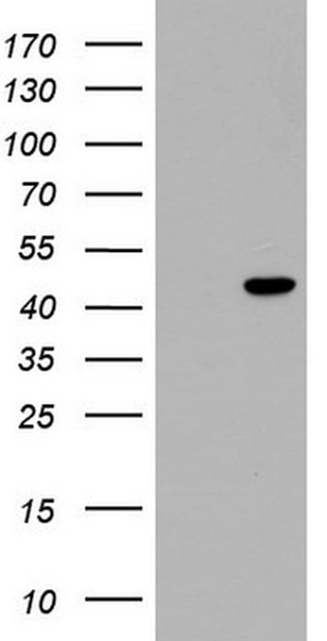 TRIM54 Antibody in Western Blot (WB)