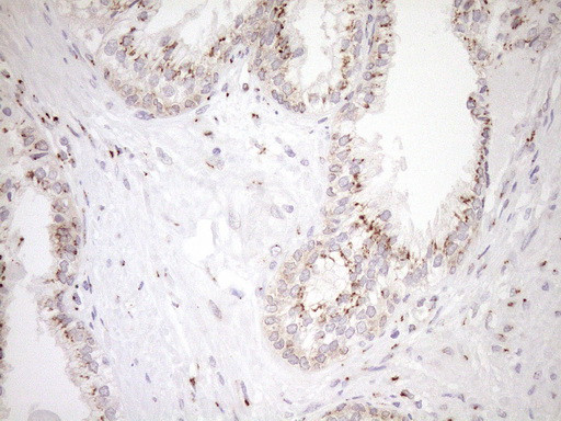 TRIM56 Antibody in Immunohistochemistry (Paraffin) (IHC (P))