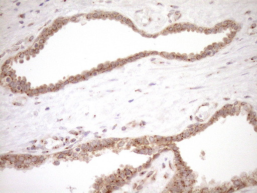 TRIM56 Antibody in Immunohistochemistry (Paraffin) (IHC (P))