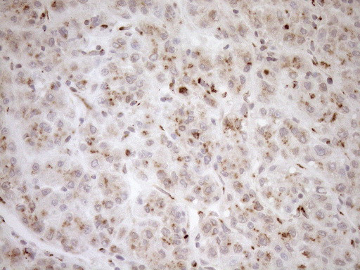 TRIM56 Antibody in Immunohistochemistry (Paraffin) (IHC (P))