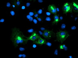 TRIM9 Antibody in Immunocytochemistry (ICC/IF)