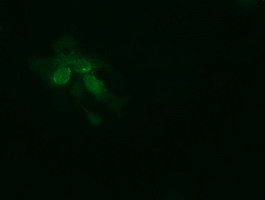 TRMT2A Antibody in Immunocytochemistry (ICC/IF)