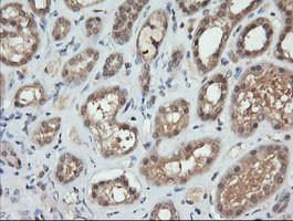 TRMT2A Antibody in Immunohistochemistry (Paraffin) (IHC (P))