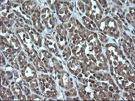 TRMT2A Antibody in Immunohistochemistry (Paraffin) (IHC (P))