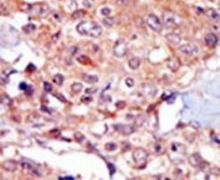 TRPM7 Antibody in Immunohistochemistry (IHC)