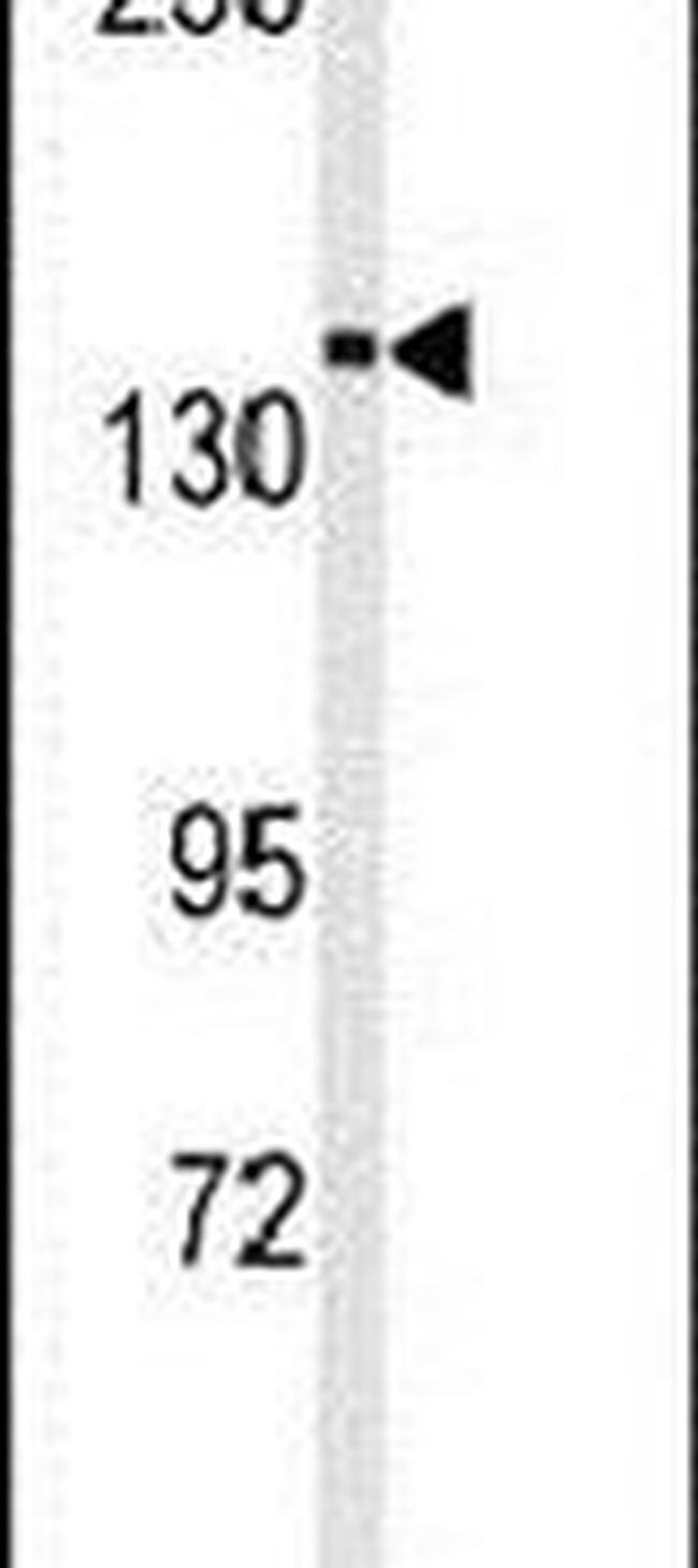 TRPM7 Antibody in Western Blot (WB)