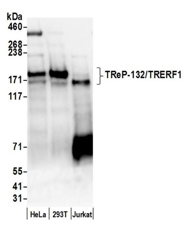 TReP-132/TRERF1 Antibody in Western Blot (WB)