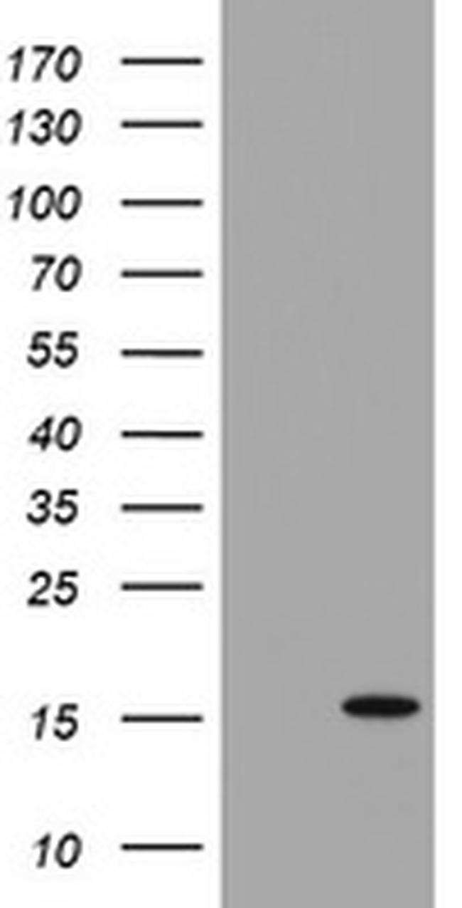 TSC22D3 Antibody in Western Blot (WB)