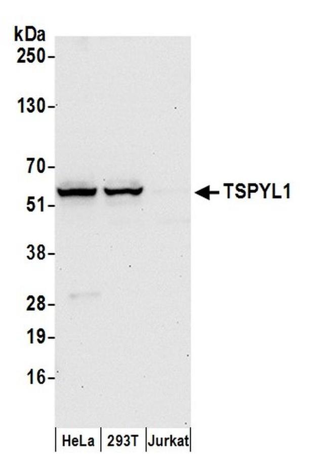 TSPYL1 Antibody in Western Blot (WB)