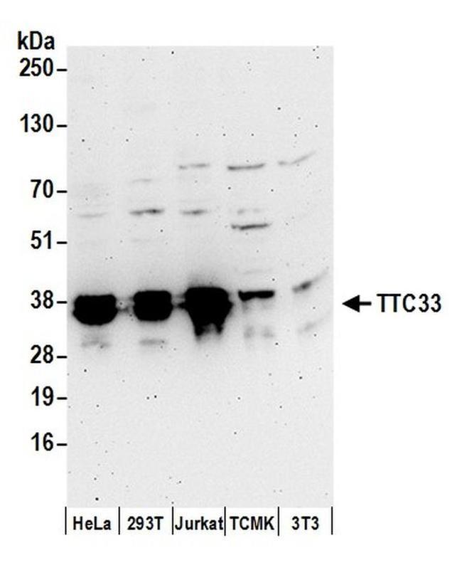 TTC33 Antibody in Western Blot (WB)