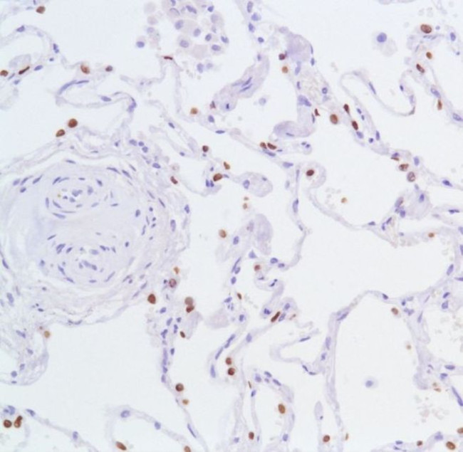 Nkx2.1 Antibody in Immunohistochemistry (IHC)