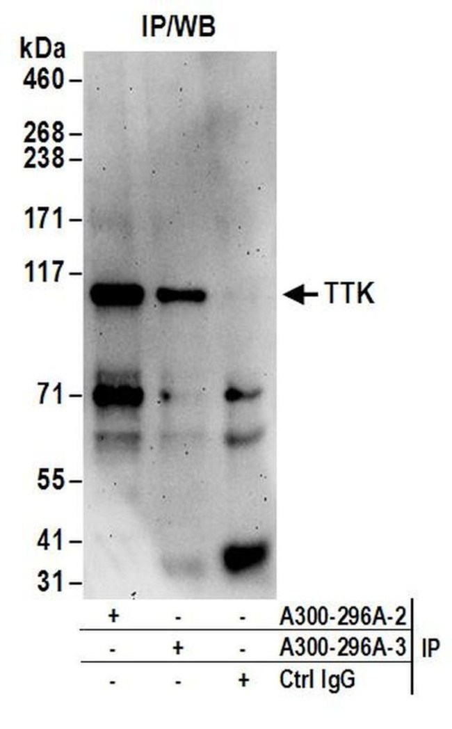 TTK Antibody in Immunoprecipitation (IP)