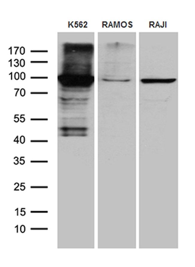 TTK Antibody in Western Blot (WB)