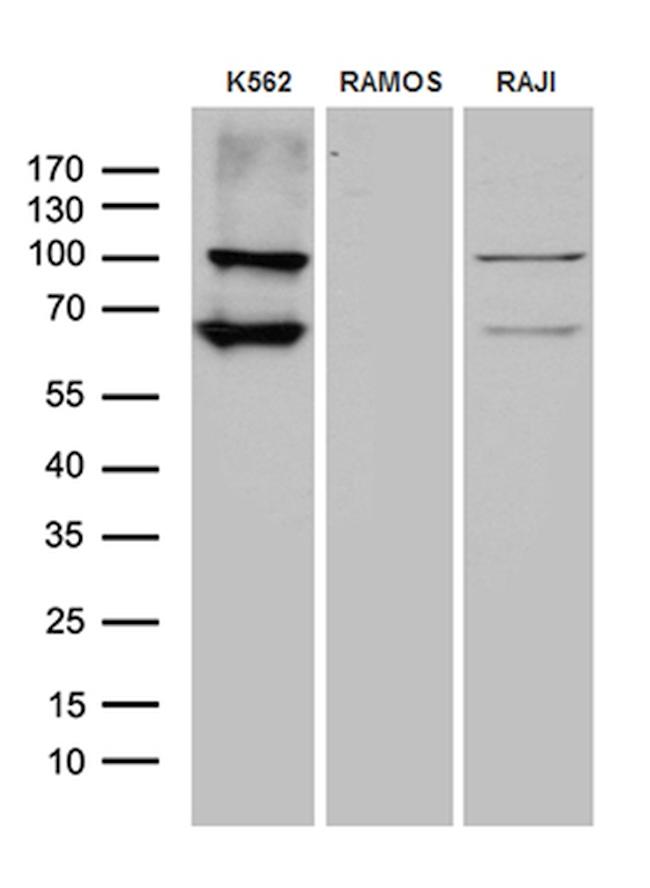 TTK Antibody in Western Blot (WB)