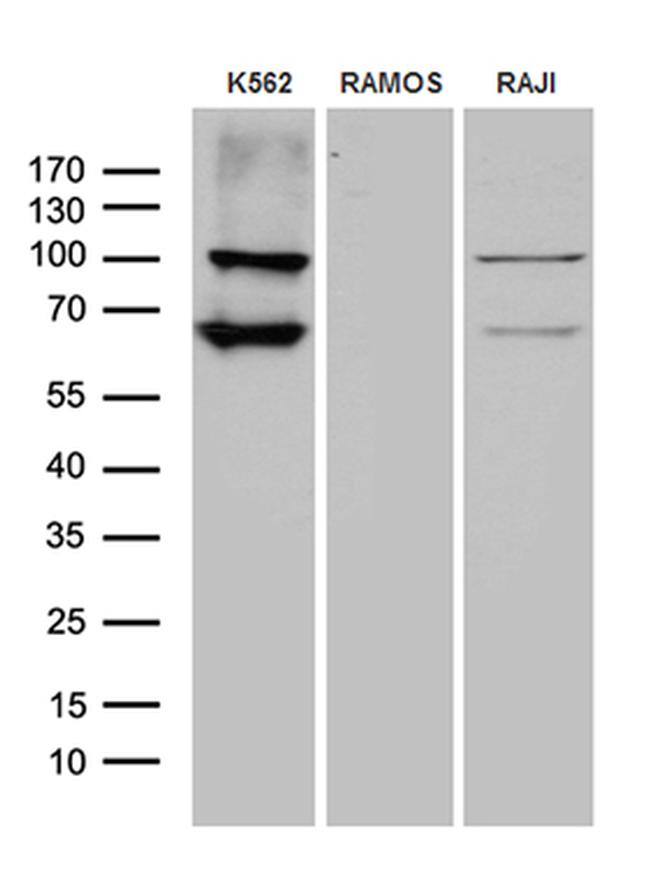 TTK Antibody in Western Blot (WB)