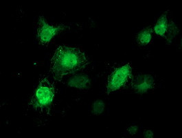 TTLL12 Antibody in Immunocytochemistry (ICC/IF)