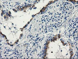 TTLL12 Antibody in Immunohistochemistry (Paraffin) (IHC (P))