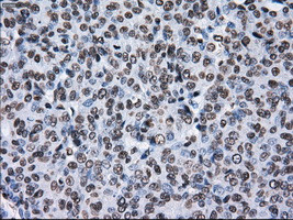 TTLL12 Antibody in Immunohistochemistry (Paraffin) (IHC (P))