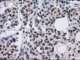 TTLL12 Antibody in Immunohistochemistry (Paraffin) (IHC (P))