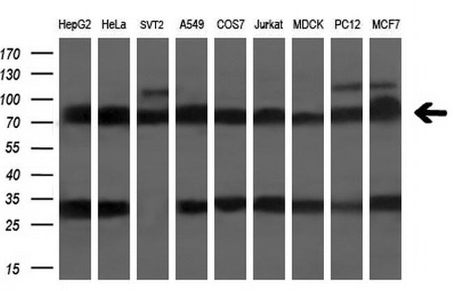 TTLL12 Antibody in Western Blot (WB)