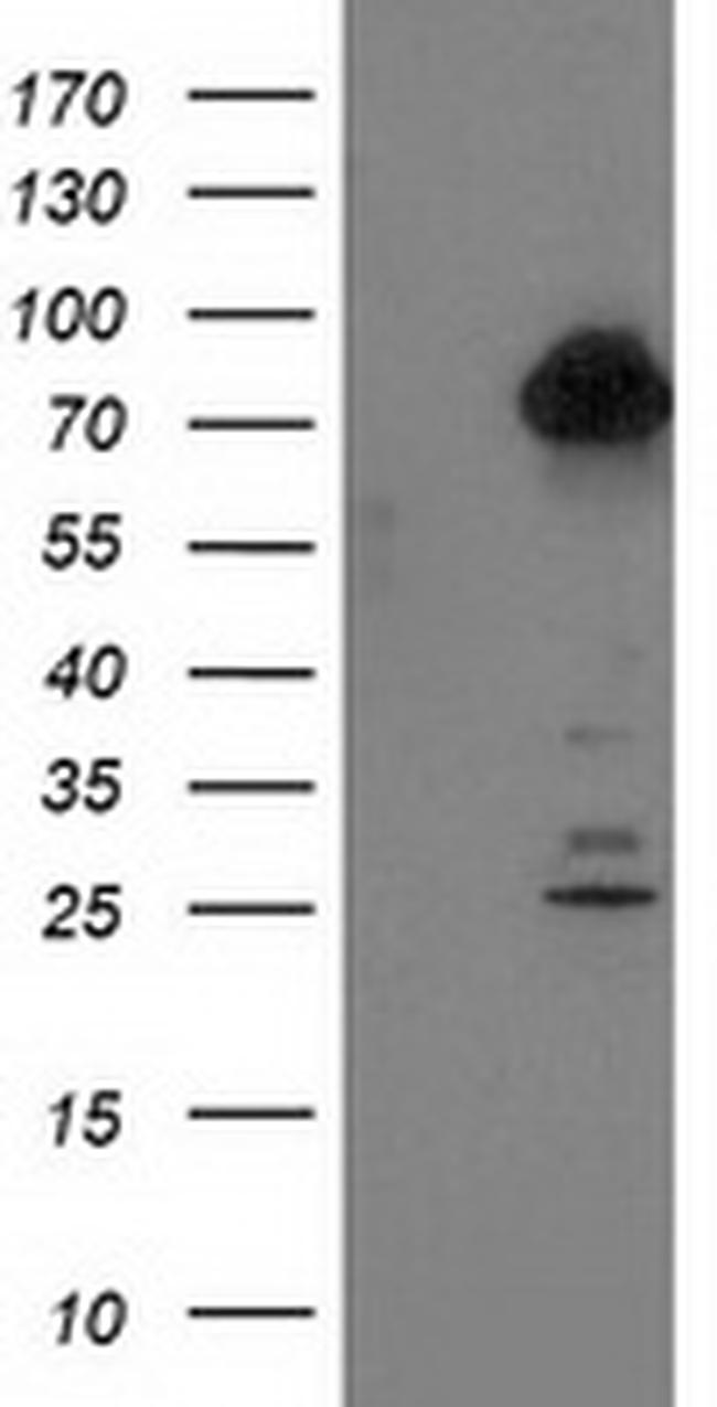 TTLL12 Antibody in Western Blot (WB)